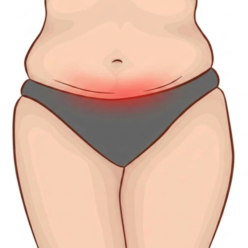 Under the belly and apron fold